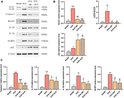 Corrigendum: Quercetin suppresses ovariectomy-induced osteoporosis in rat mandibles by regulating autophagy and the NLRP3 pathway